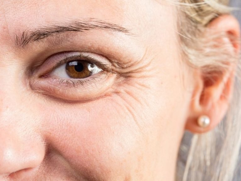 Rejuvenescimento com skinbooster Curitiba