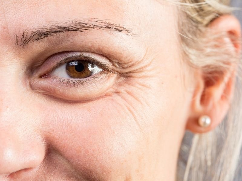 Rejuvenescimento com skinbooster Curitiba