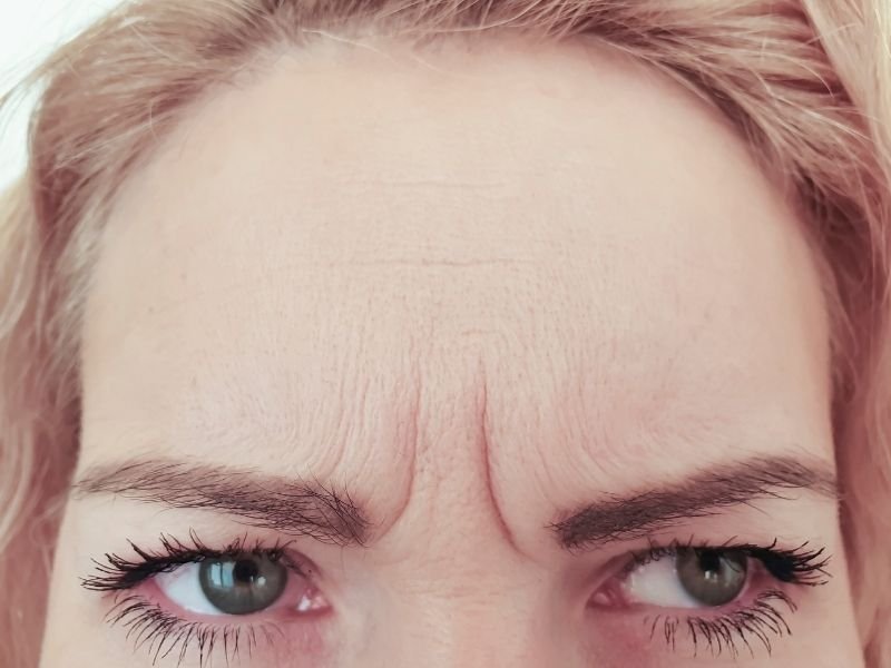 Botox masculino Curitiba