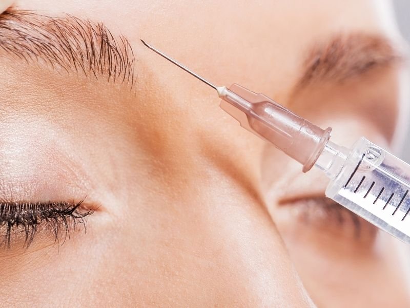 Melhor harmonização facial em Curitiba