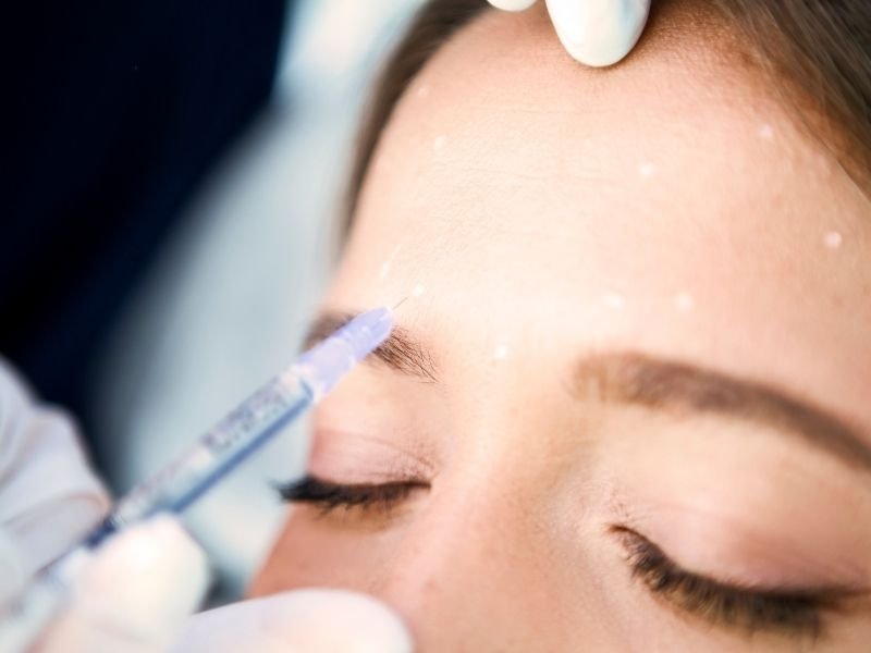 Reposição de colágeno facial Curitiba