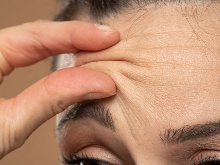 Toxina botulínica facial Curitiba