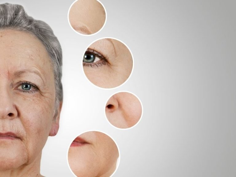 Cuidados pós Botox Curitiba