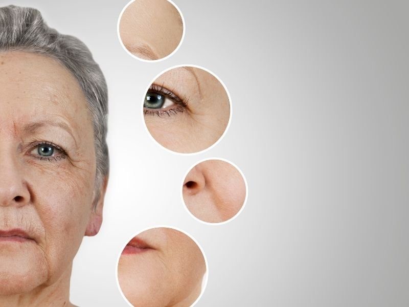 Cuidados pós Botox Curitiba