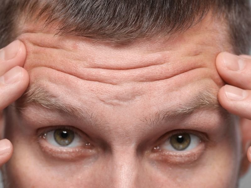 Botox para pés de galinha Curitiba