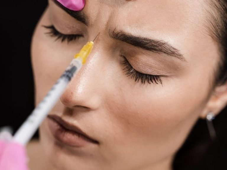 Harmonização facial com Botox Curitiba