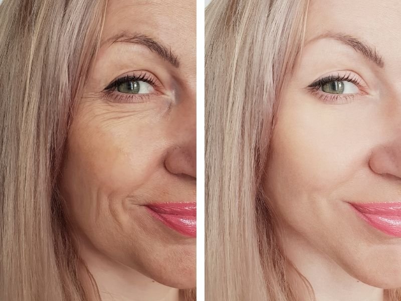 Rejuvenescimento facial personalizado Curitiba