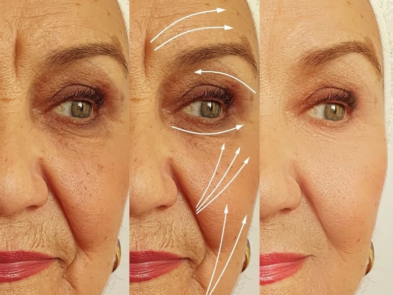 Harmonização facial segura e natural Curitiba