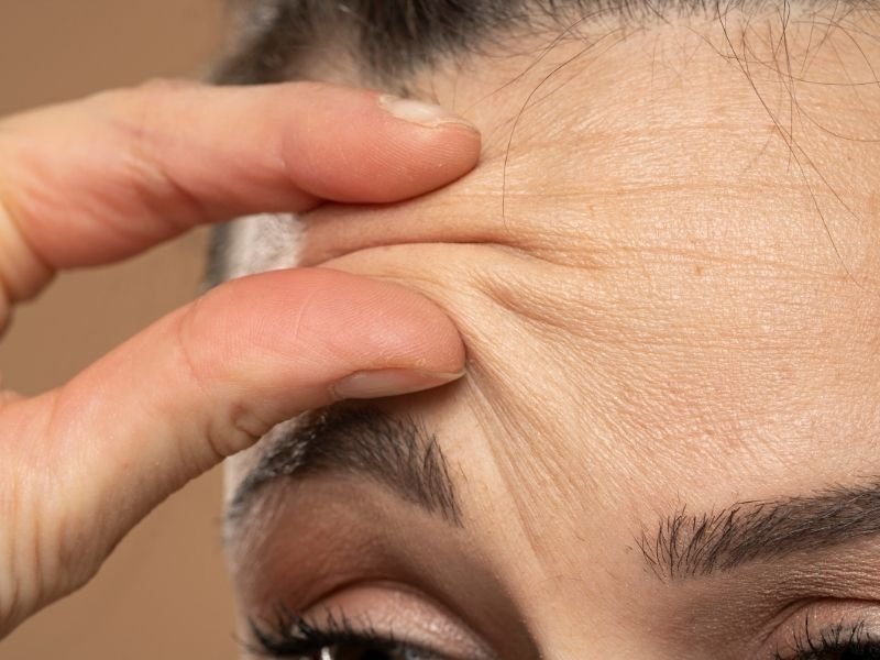 Tratamento de rugas faciais Curitiba