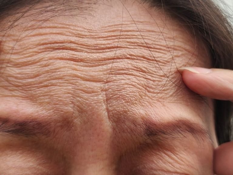 Harmonização Facial bairro Centro Curitiba