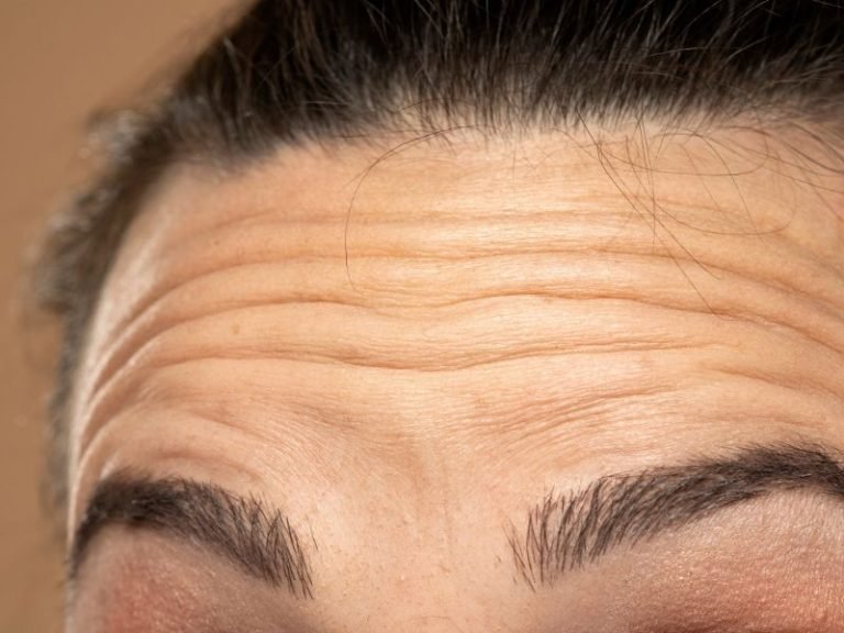 Botox no bairro Mercês em Curitiba