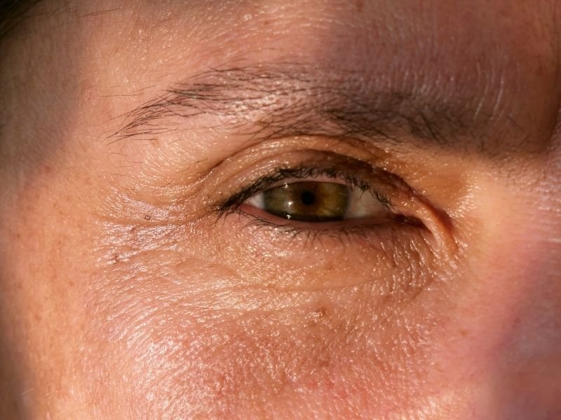 Botox no bairro Prado Velho em Curitiba