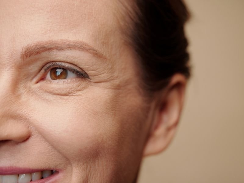 Rejuvenescimento facial em Curitiba