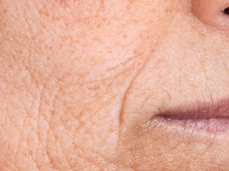 Estética facial avançada Curitiba