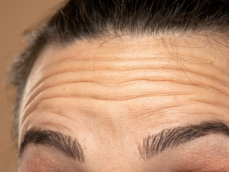 Especialista em preenchimento labial Curitiba